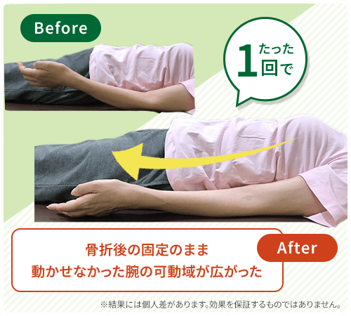 ビフォーアフター